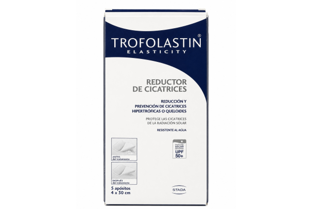 Trofolastin Elasticity Scar Reducer Patches Hypertrophic & Keloid Scar Dressings – 5 x 4x30cm – UPF 50+